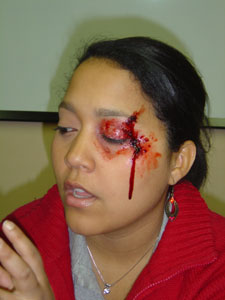 Carla, simulacre de ferida al ull
